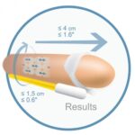 16070 ANDROEXTENDER – ANDROPENIS BASIC TRATTAMENTO PER L’INGRANDIMENTO DEL PENE